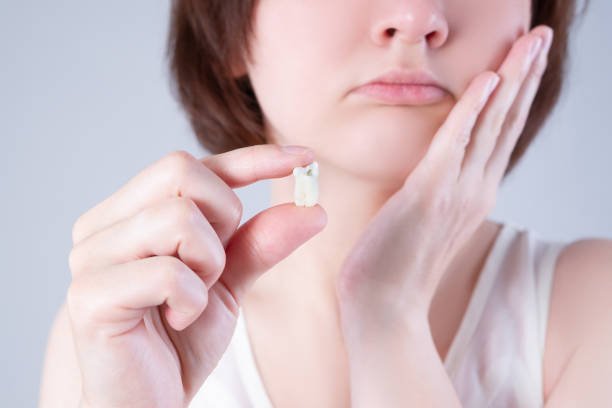 When Is the Right Time for Wisdom Teeth Removal? – Telegraph